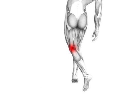 Arthrose de l'articulation du genou