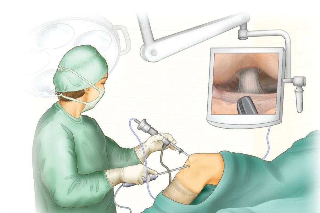 Chirurgie conjointe du genou