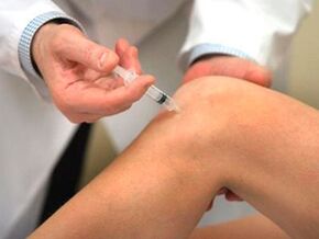 Comment traiter l'arthrose de l'articulation du genou