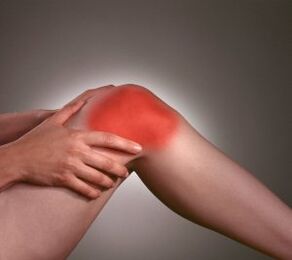 Symptômes d'arthrose de l'articulation du genou